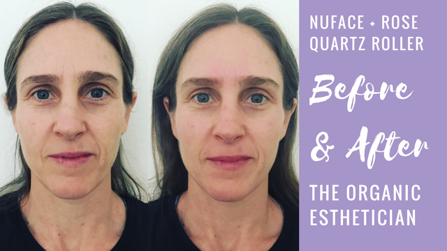 Nuface & Rose Quartz Roller Results in Your 40's - Demo + Before and After