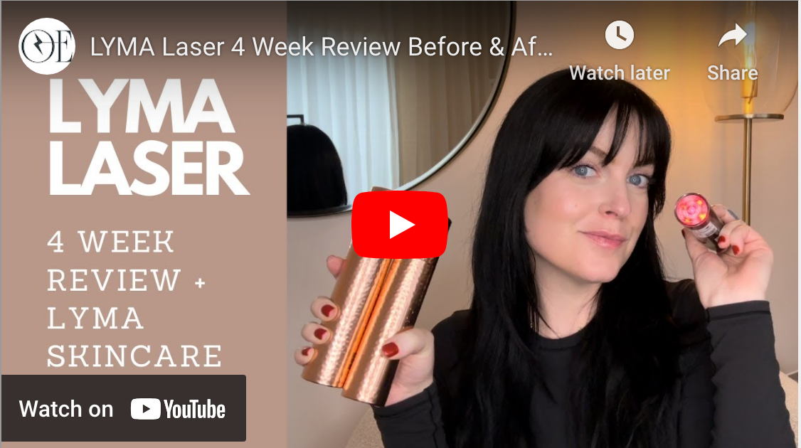 LYMA Laser 4 Week Review Before & After | LYMA Skincare